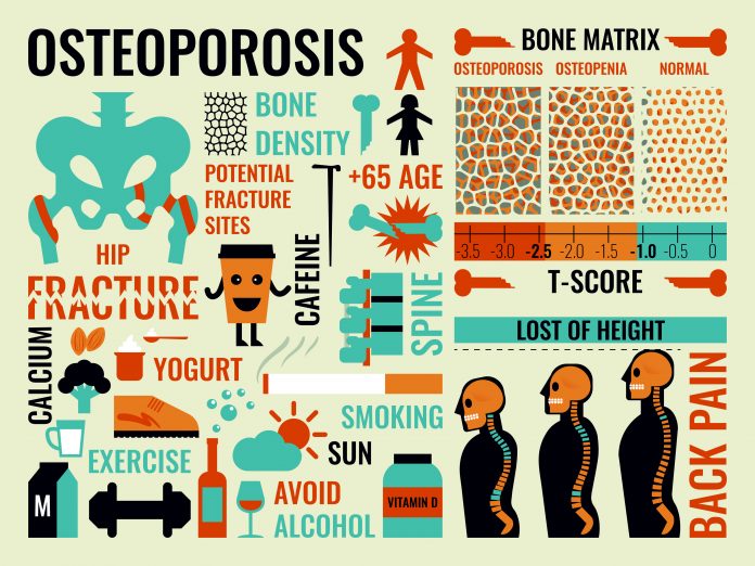 SLM Osteoporosis scaled