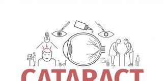 cataract scaled