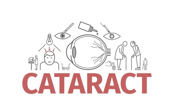 cataract scaled
