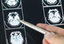 brain