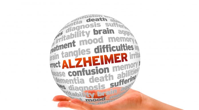 alzheimer article scaled