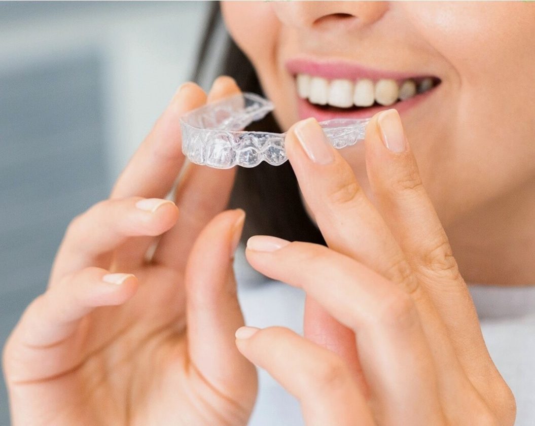 SLM | Things You Need to Know About Invisalign Before Taking the Plunge
